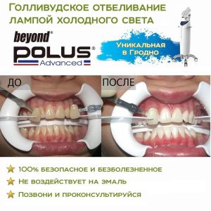 Отбеливание зубов в Гродно Отбеливание зубов в Гродно
