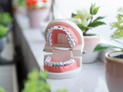 Протезирование